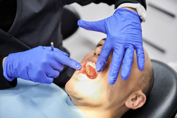 Best Emergency Tooth Extraction in Itasca, TX