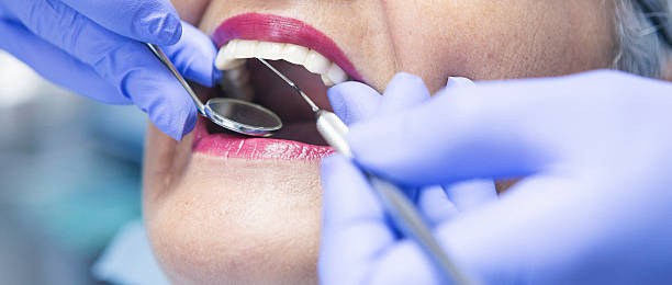 Best Emergency Treatment for Toothache in Itasca, TX
